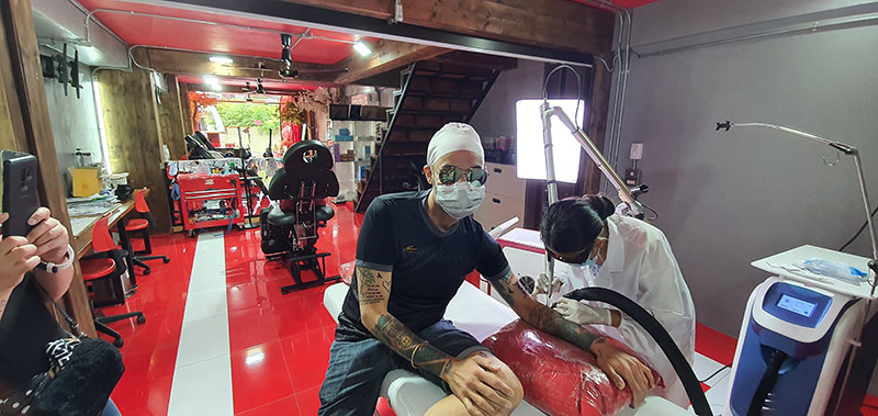 Tattoo Removal Bangkok